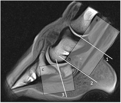 Comparison Between Ultrasonographic and Standing Magnetic Resonance Imaging Findings in the Podotrochlear Apparatus of Horses With Foot Pain